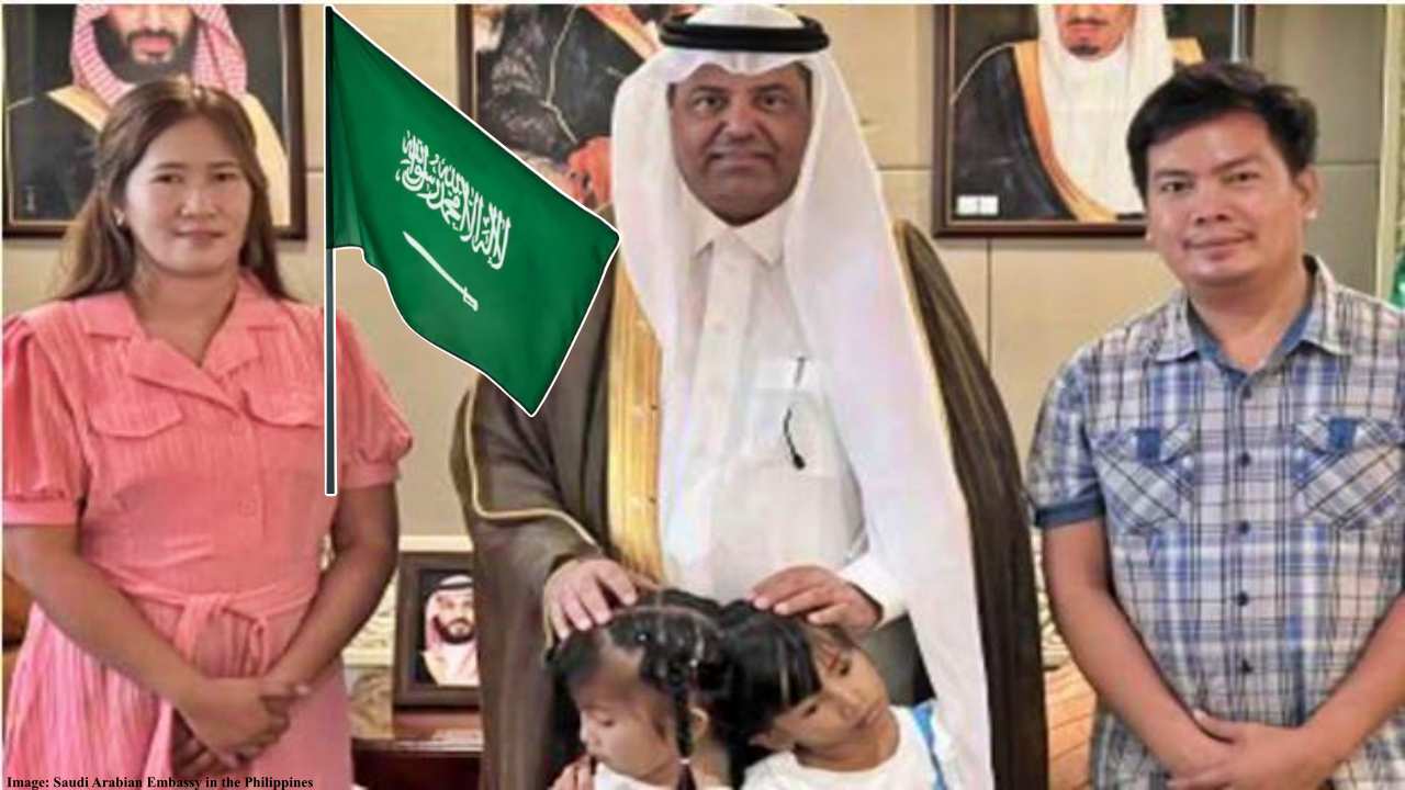 Filipino Conjoined Twins Successfully Separated in Saudi Arabia